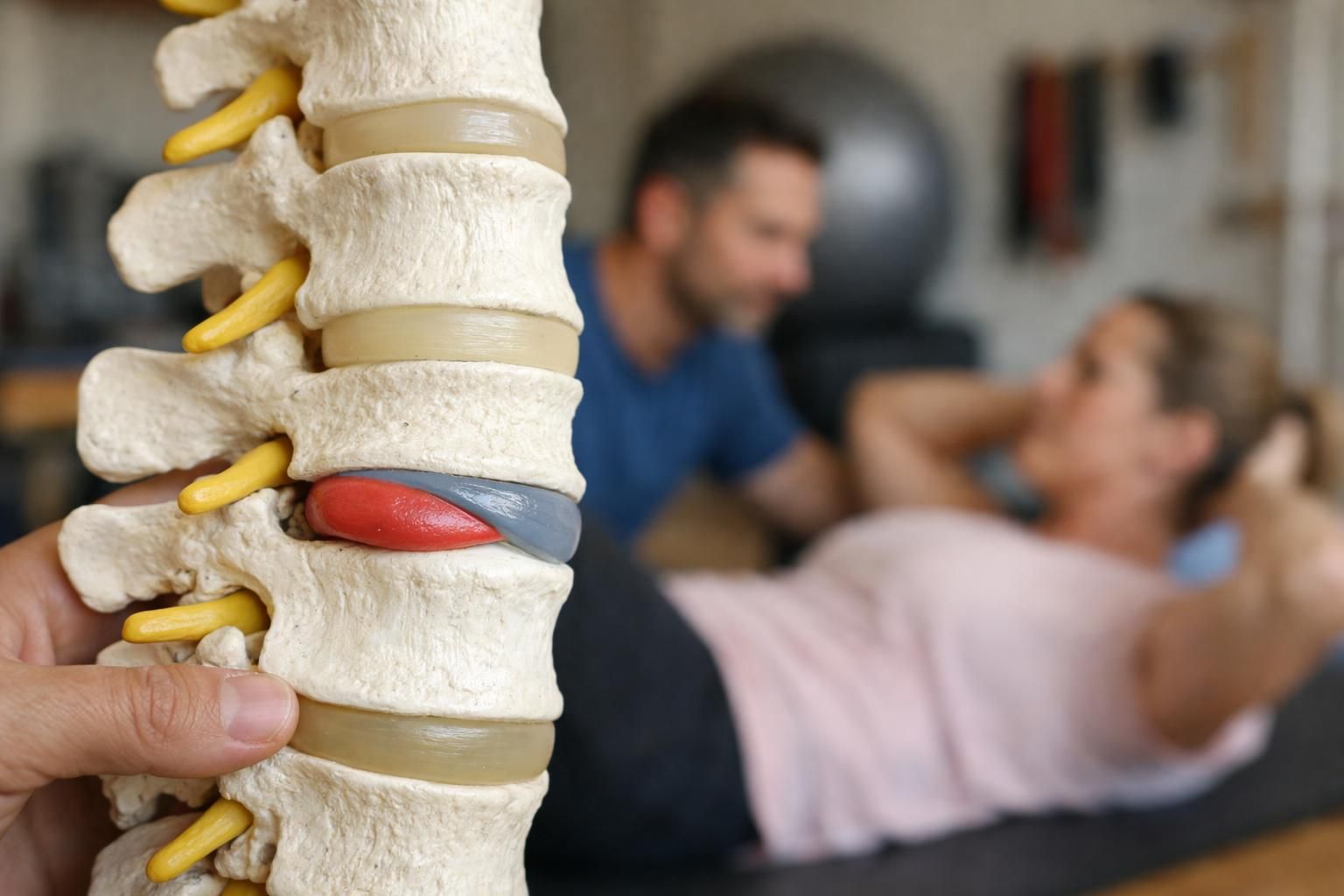 Spine model with herniated disc in physical therapy clinic