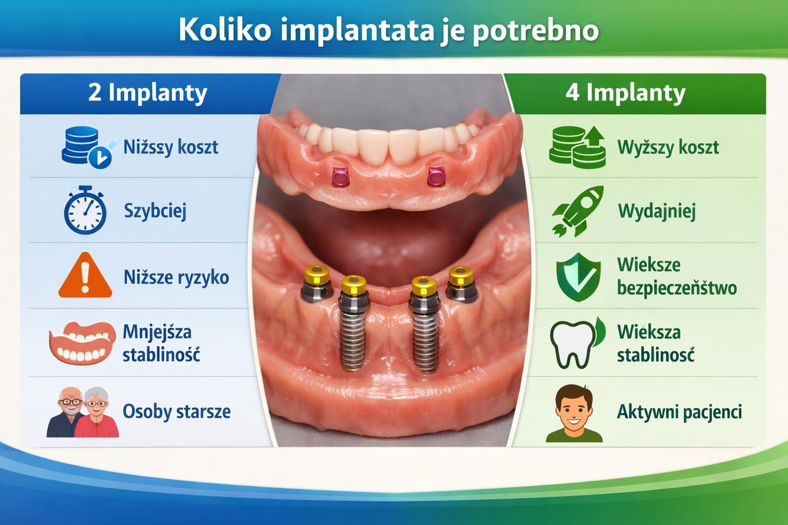 Diagram comparing two versus four dental implants in dentures
