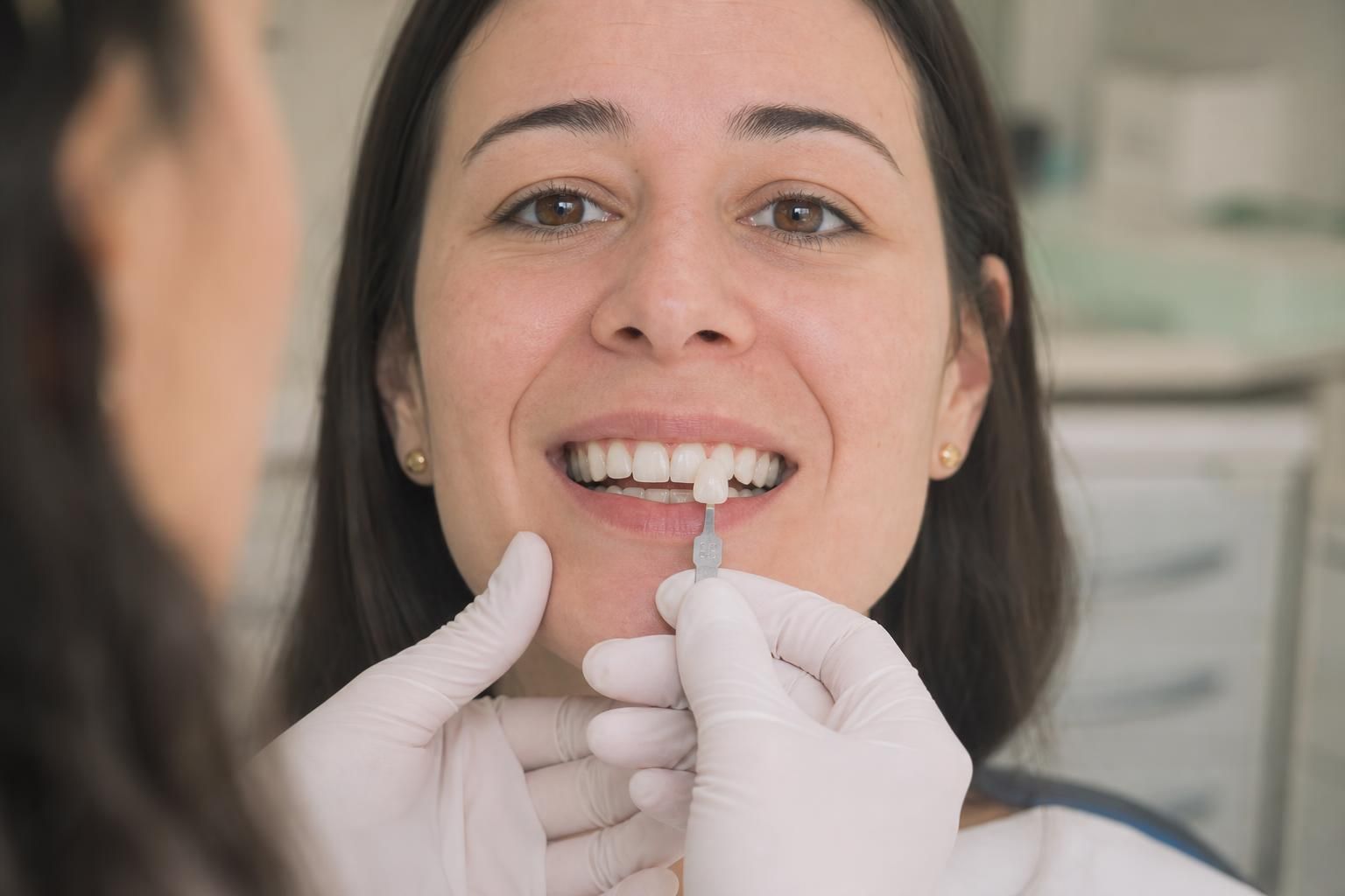 Dentist compares tooth shade with a guide in a patient&rsquo;s mouth